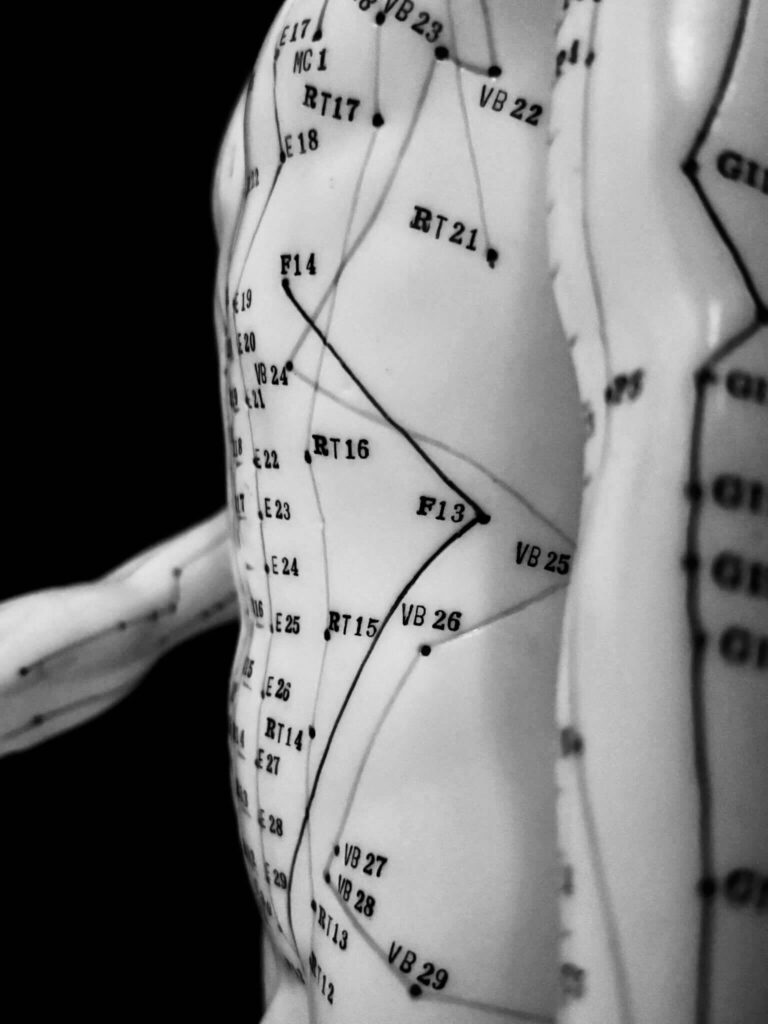 acupuncture a montpellier